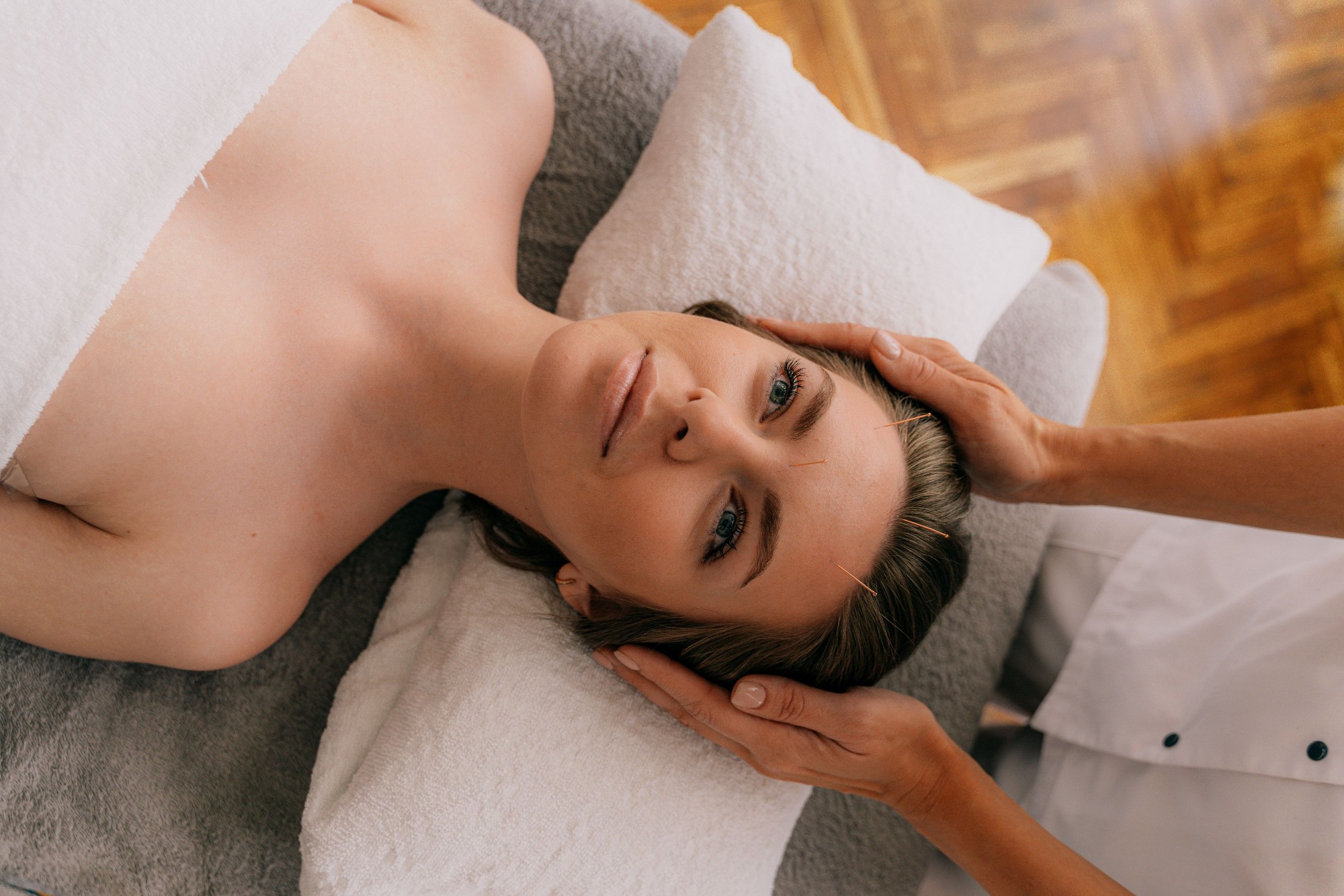 Cosmetic acupuncture with fine needles on the face