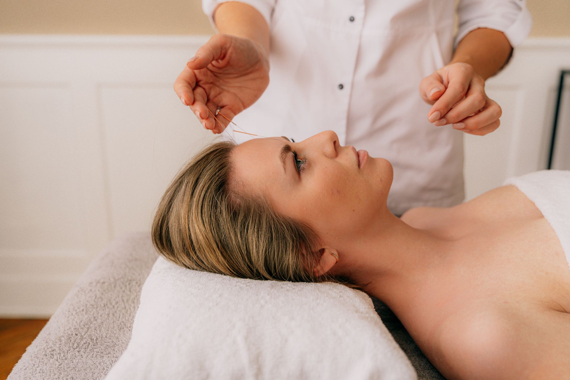 Practitioner placing cosmetic acupuncture needles on the forehead